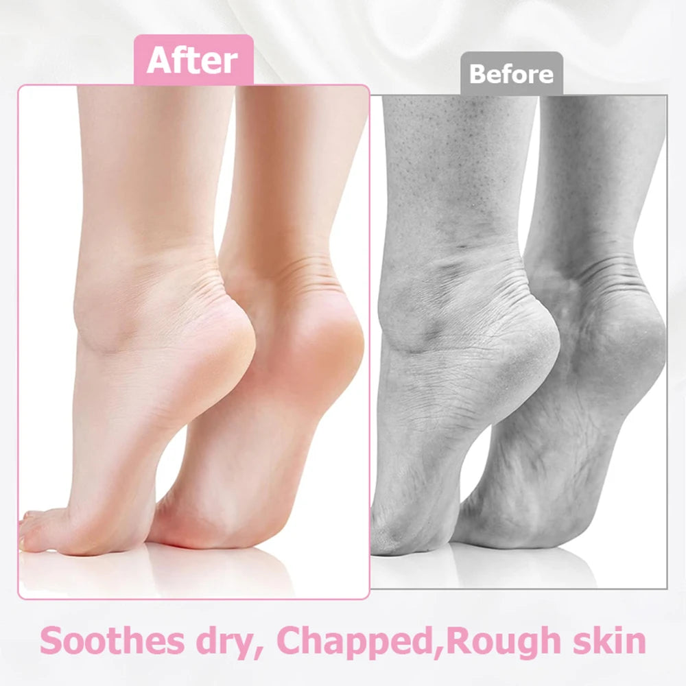2 Pack Moisturizing Silicone Gel Socks for Dry Cracked Feet