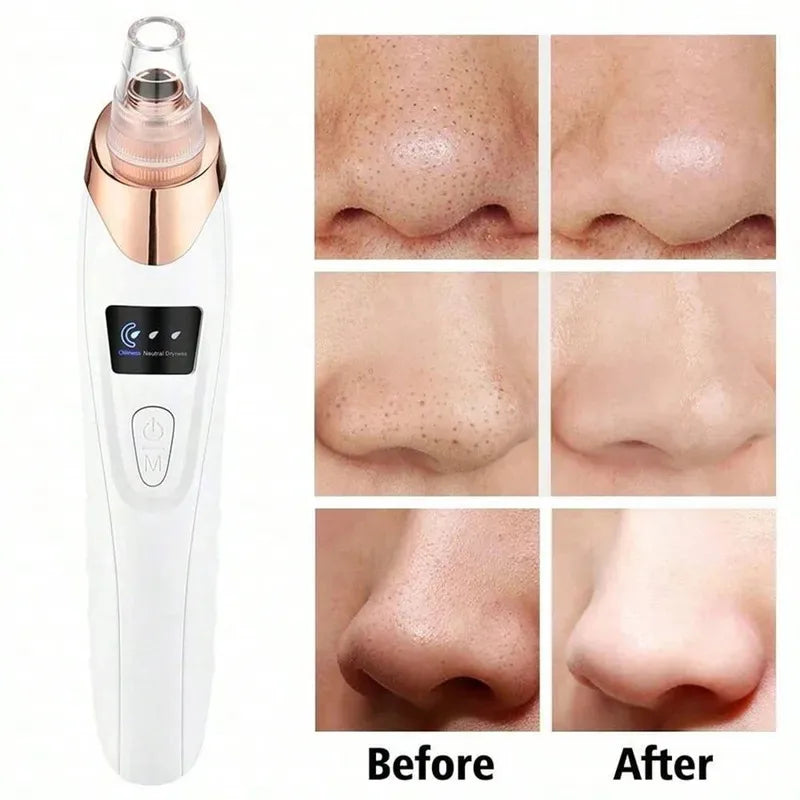 Electric Blackhead Remover Vacuum Cleaner Black Spots