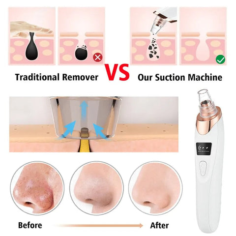 USB Rechargeable Facial Pore Cleaner with Blackhead Removal