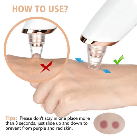 USB Rechargeable Facial Pore Cleaner with Blackhead Removal